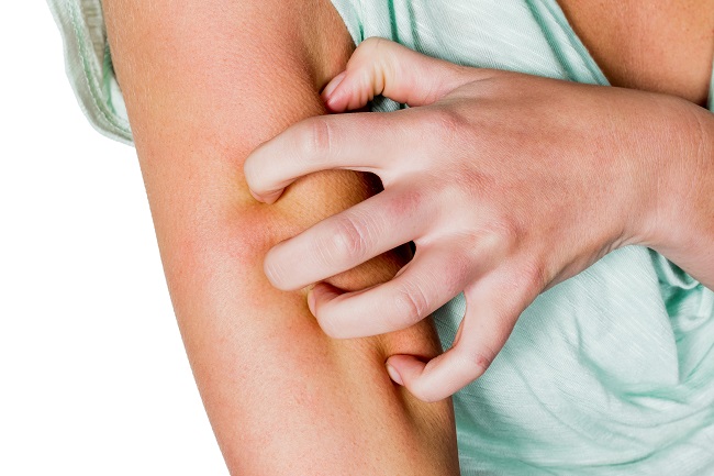 What are the Most Common Causes of Skin Allergies?